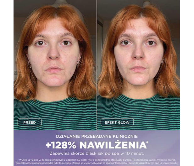 Shark Hydroaktywny system pielęgnacji twarzy FacialPro Glow FH320E - 1568664 - zdjęcie 5